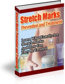 Stretch Marks Prevention and Treatment